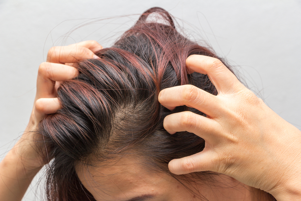How to Ease an Itchy/Dry Scalp | Crave Beauty Academy